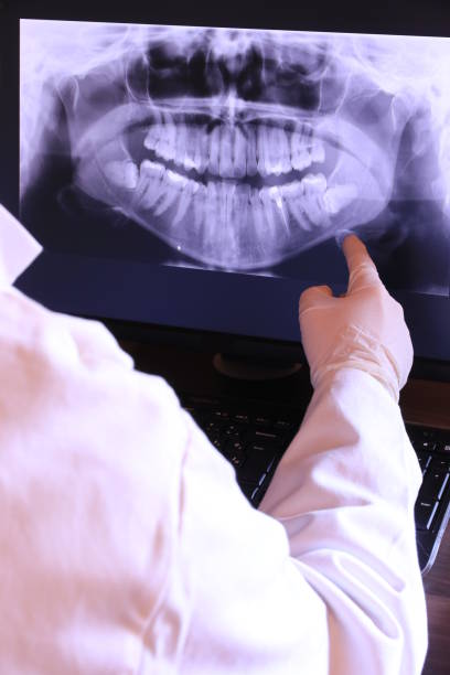 Best Emergency Dentist for Lost Fillings or Crowns in Cedar Bluff, AL